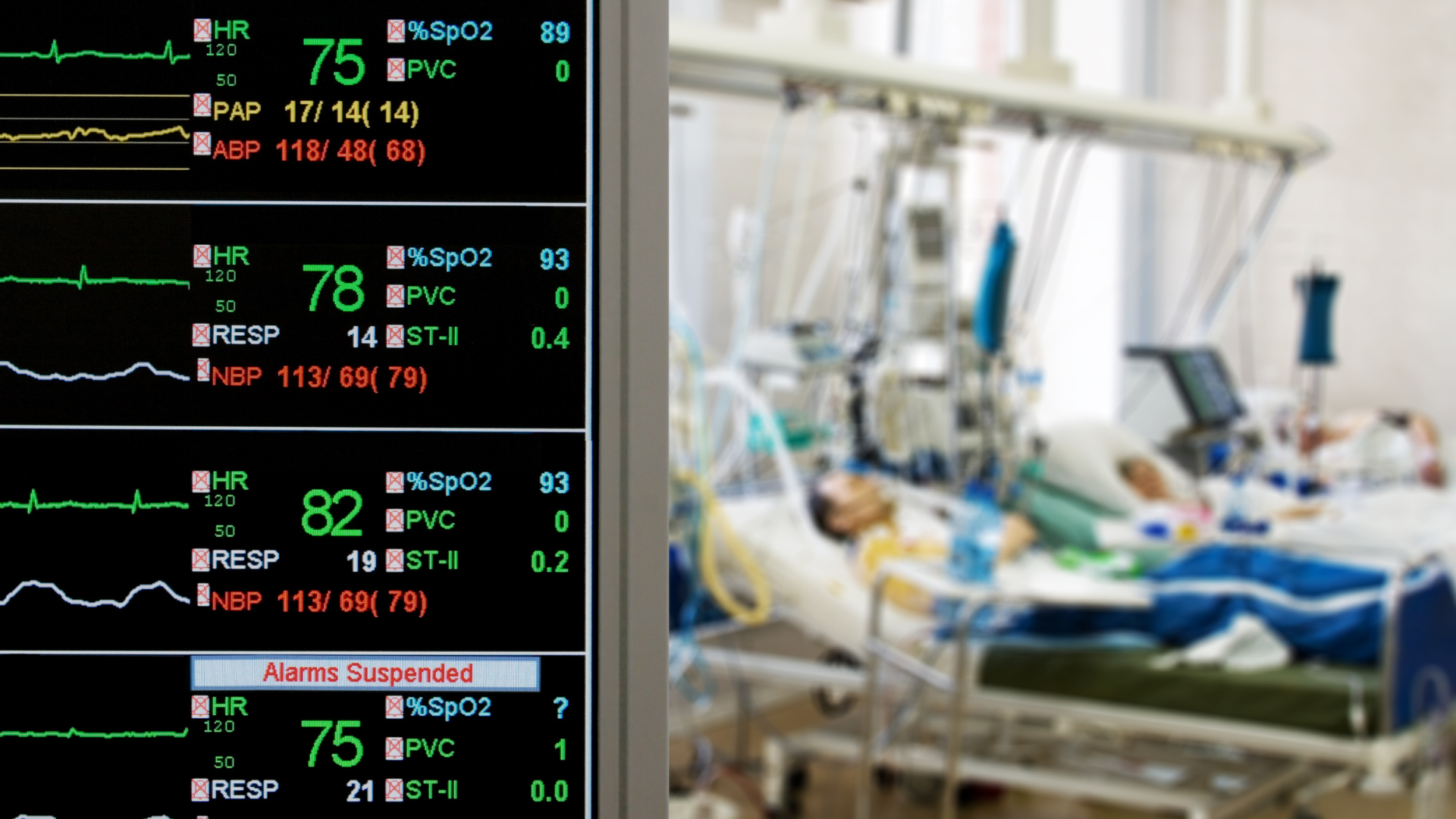 Gestão de Leitos de UTI: O Que Fazer Se Não Há Leito Para Você